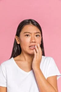 kulit kusam